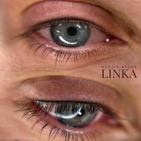 medziriasová linka