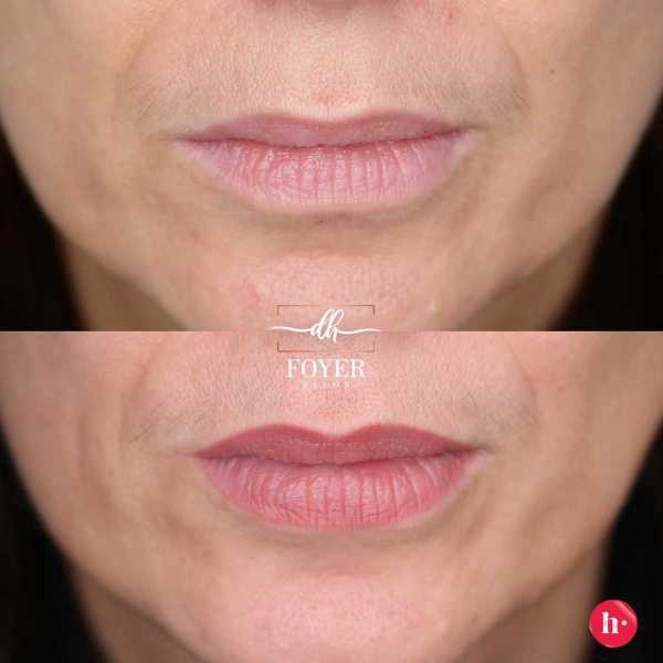 permanentný makeup-  zahojené  pery