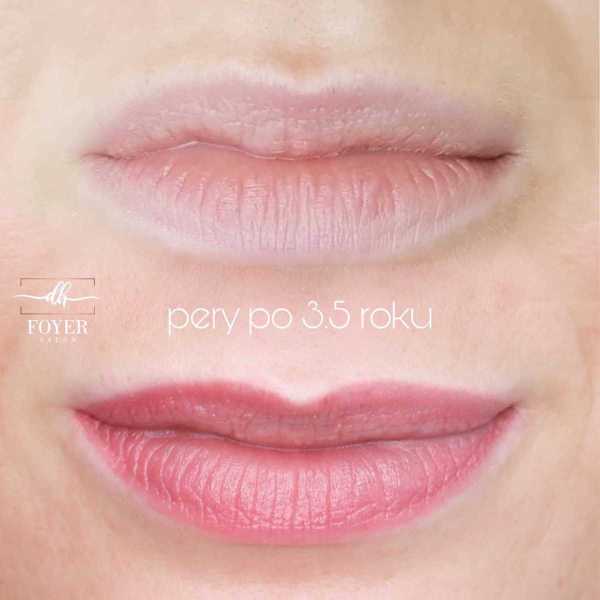 permanentný makeup pier-  zahojené po 3,5 roku
